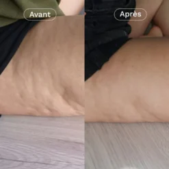 Complément alimentaire minceur cellulite